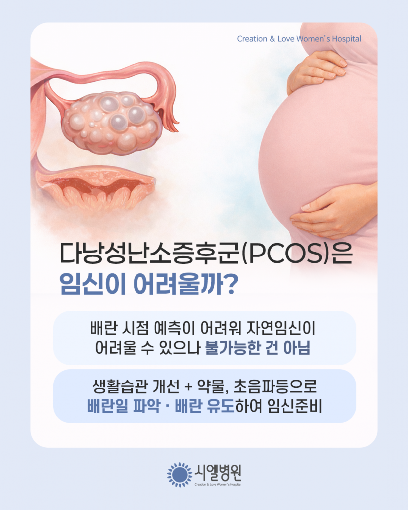 다낭성난소증후군, 임신이 정말 어려울까? 다낭성증후군과 다낭성 치료 - 시엘병원 최범채원장 첨부파일 : 1773648475.png