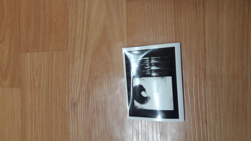 임신7주차인데 지우려고요 첨부파일 : 1486541053.jpg