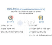 시엘병원 인공수정 검사 전 절차와 시술과정